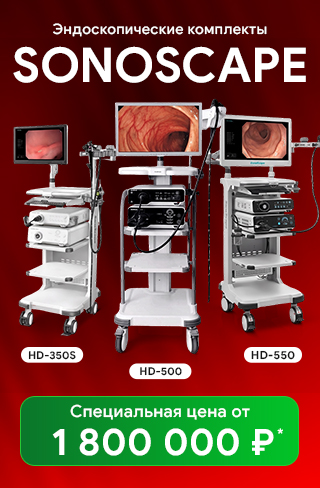 SonoScape