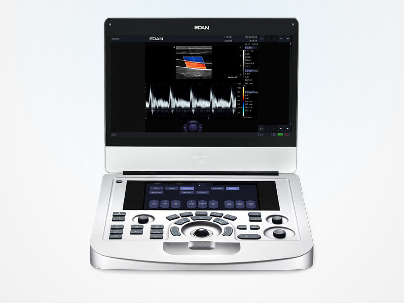 M-режим, анатомический M-режим (AMM)